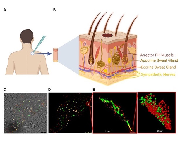 Imagen: Pasos y metodología del procesamiento de biopsias de piel para análisis dSTORM (foto cortesía del Front. Mol. Neurosci. (2024); DOI: 10.3389/fnmol.2024.1431549)